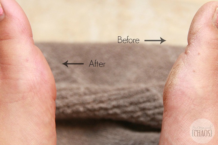 Amopé Pedi Perfect review before and after